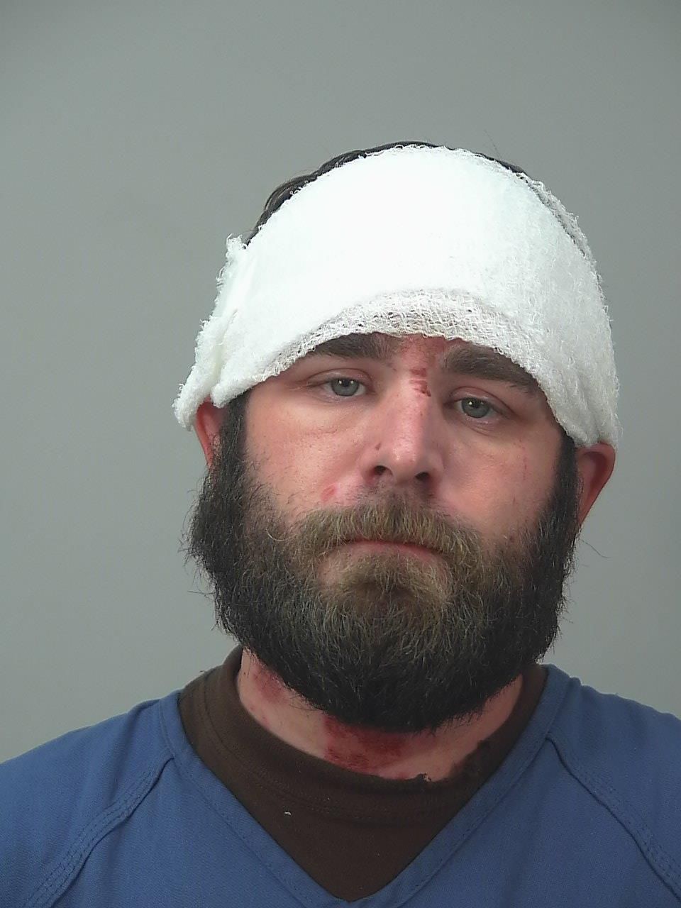Search warrant: Madison man made death threat before pouring chemical on other man